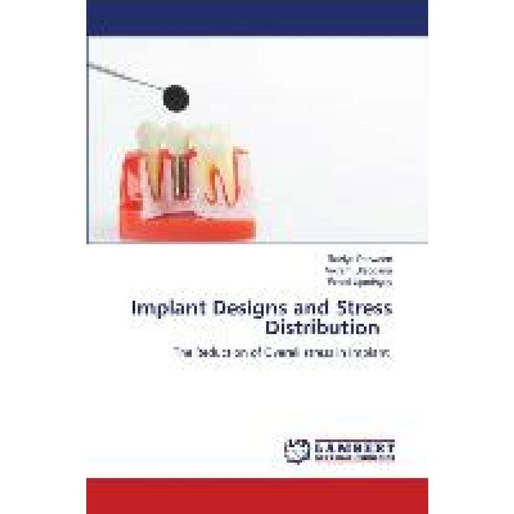 Perween, Raziya: Implant Designs and Stress Distribution