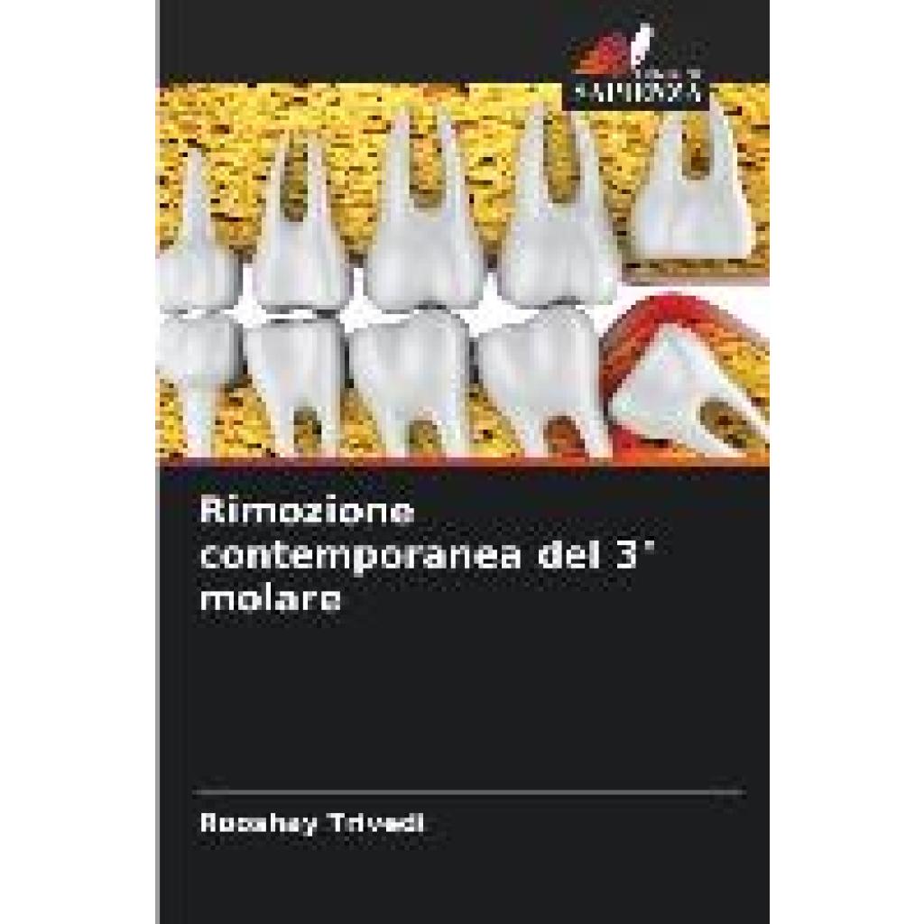 Trivedi, Rooshay: Rimozione contemporanea del 3° molare