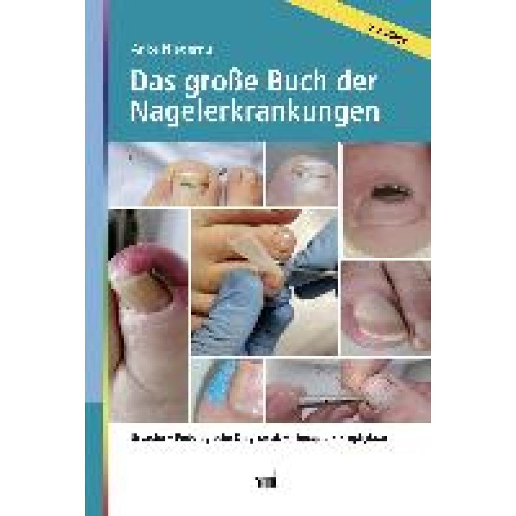 Das große Buch der Nagelerkrankungen (Niederau, Anke)