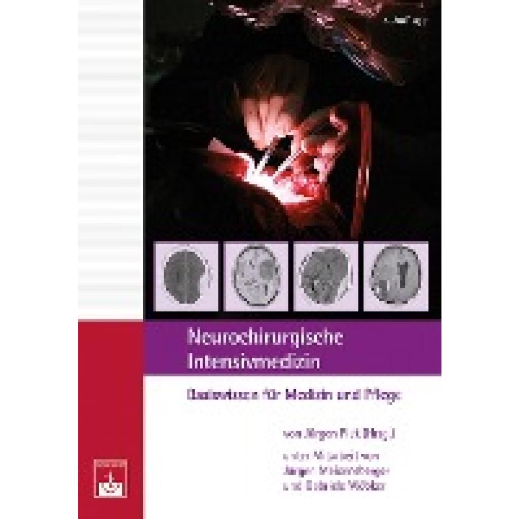 9783863712297 - Neurochirurgische Intensivmedizin Kartoniert (TB)