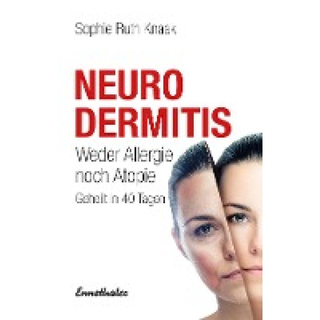 9783850685184 - Neurodermitis - Sophie R Knaak Kartoniert (TB) 9783850685184 - Neurodermitis - Sophie R Knaak Kartoniert (TB)