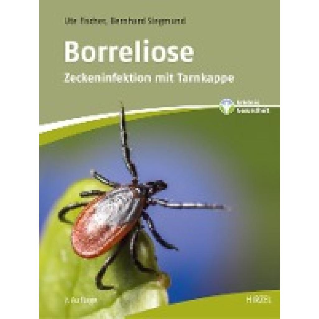 9783777628165 - Borreliose - Ute Fischer Bernhard Siegmund Kartoniert (TB)