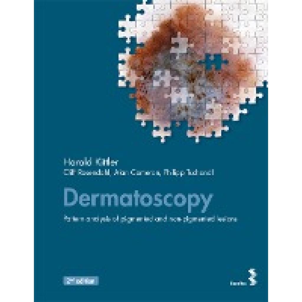 9783708913858 - Dermatoscopy - Harald Kittler Cliff Rosendahl Alan Cameron Philipp Tschandl Kartoniert (TB) 9783708913858 - Dermatoscopy - Harald Kittler Cliff Rosendahl Alan Cameron Philipp Tschandl Kartoniert (TB)