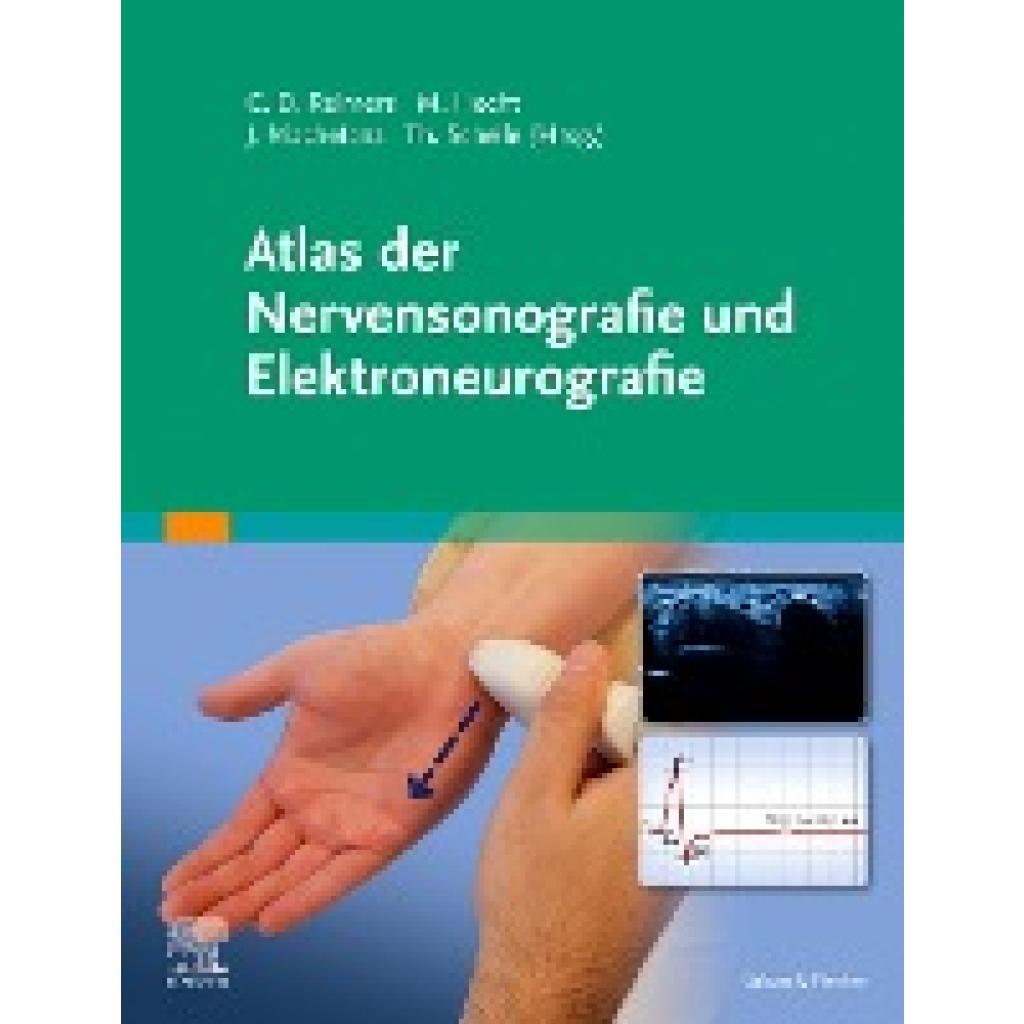 Atlas der Nervensonografie und Elektroneurografie