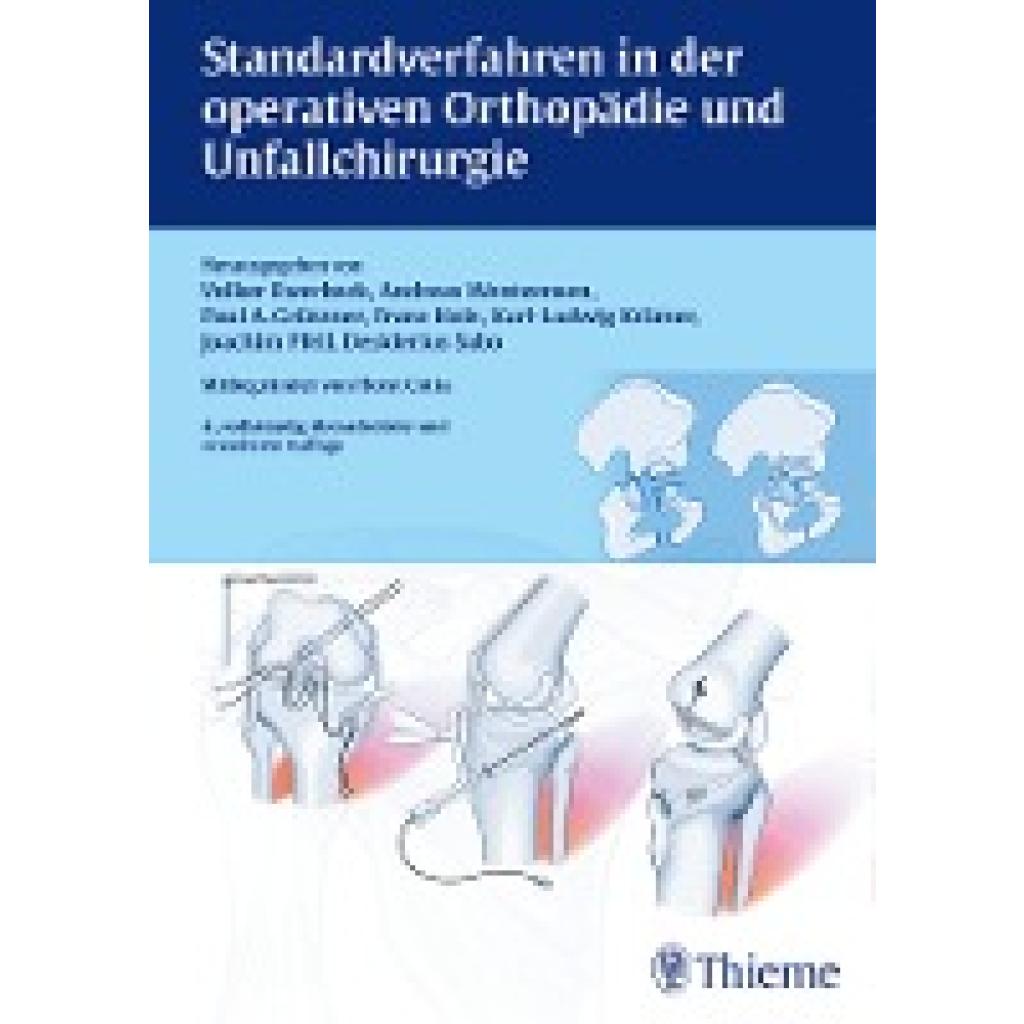 Standardverfahren in der operativen Orthopädie und Unfallchirurgie