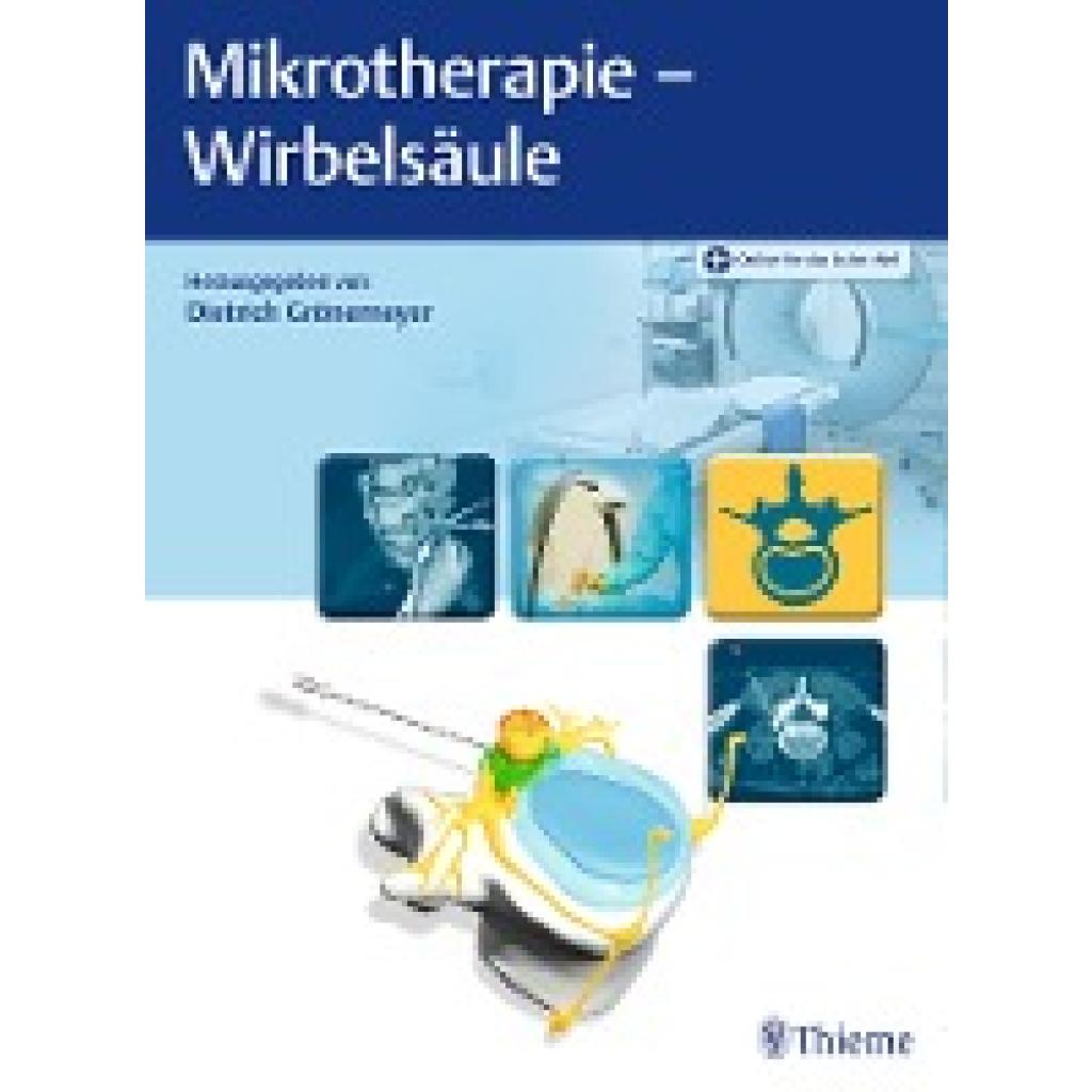 9783132416673 - Mikrotherapie - Wirbelsäule