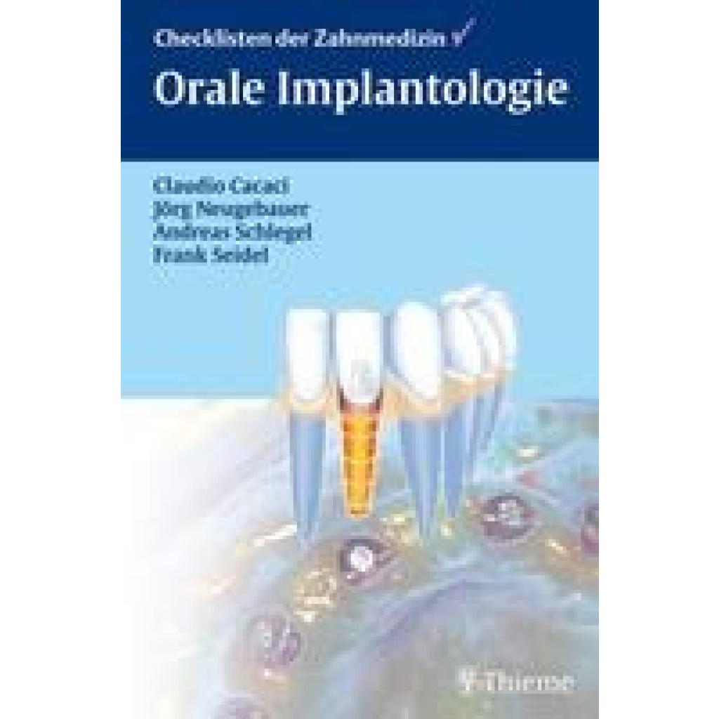 Cacaci, Claudio: Checkliste Orale Implantologie