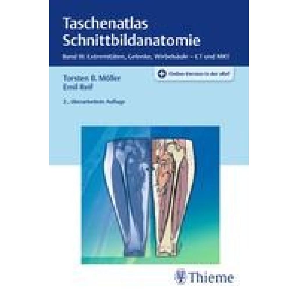 9783131392626 - Möller Torsten Bert Taschenatlas Schnittbildanatomie 03 9783131392626 - Möller Torsten Bert Taschenatlas Schnittbildanatomie 03