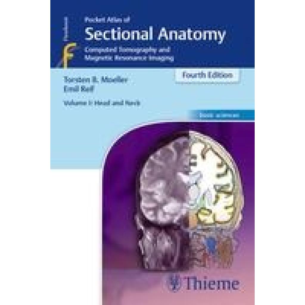 9783131255044 - Pocket Atlas of Sectional Anatomy 1 Head and Neck - Torsten Bert Moeller Torsten Bert Möller Emil Reif Kartoniert (TB)