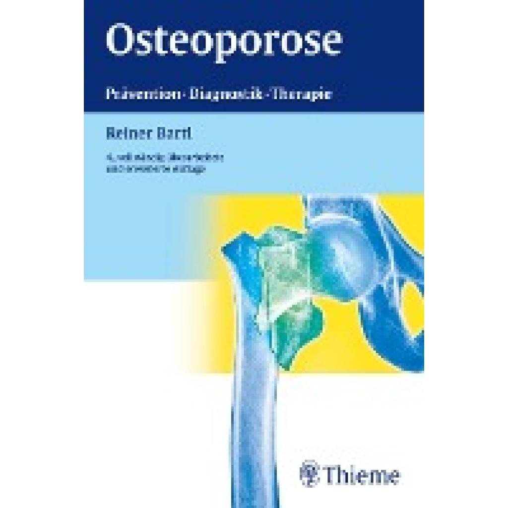 9783131057549 - Osteoporose - Reiner Bartl Kartoniert (TB)