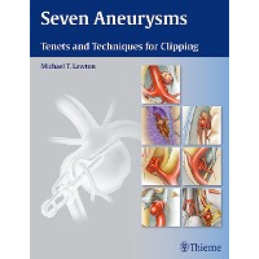 Lawton, Michael T.: Seven Aneurysms