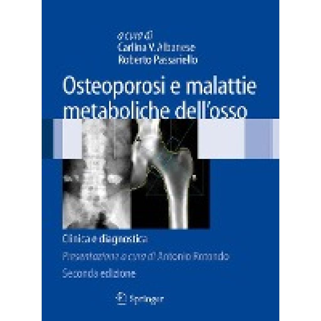 Osteoporosi E Malattie Metaboliche Dell'osso: Clinica E Diagnostica