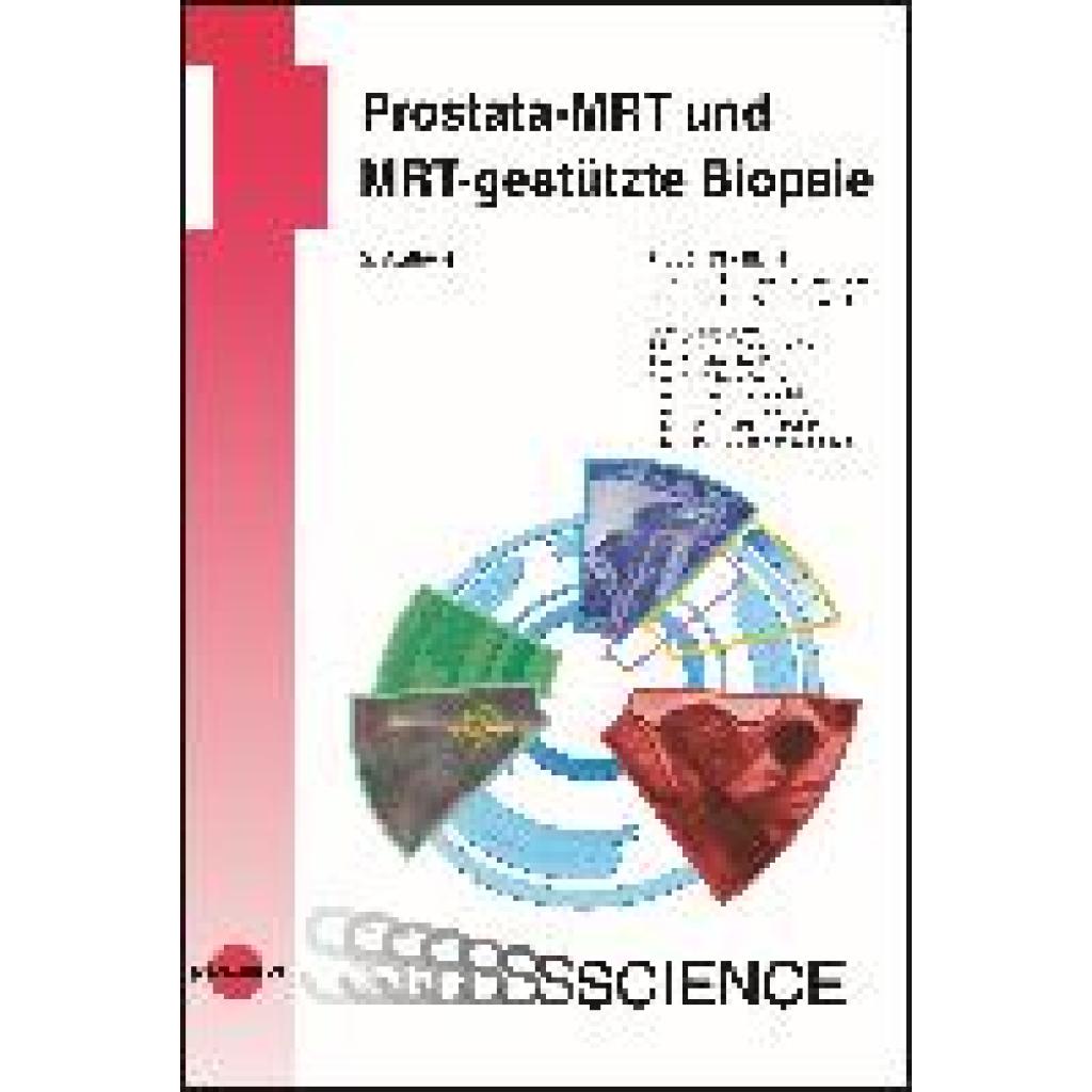 9783837415896 - UNI-MED Science   Prostata-MRT und MRT-gestützte Biopsie - Dirk Blondin Lars Schimmöller Michael Quentin Gebunden