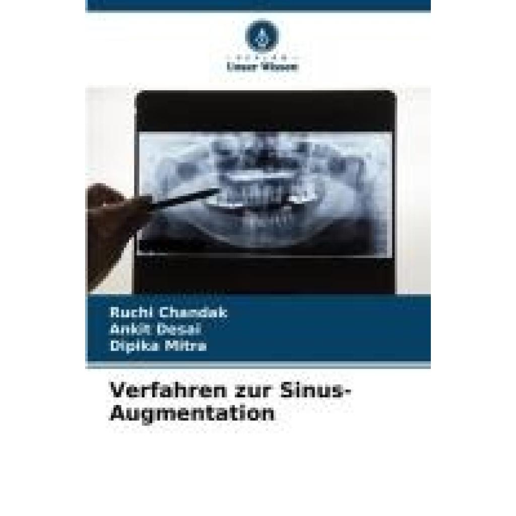 Chandak, Ruchi: Verfahren zur Sinus-Augmentation
