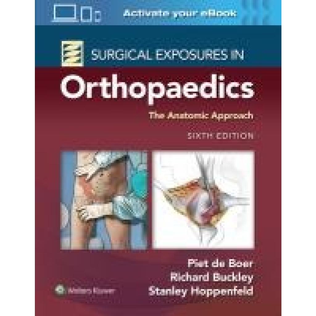 9781975168797 - Surgical Exposures in Orthopaedics The Anatomic Approach - Piet de Boer Richard Buckley Stanley Hoppenfeld Gebunden