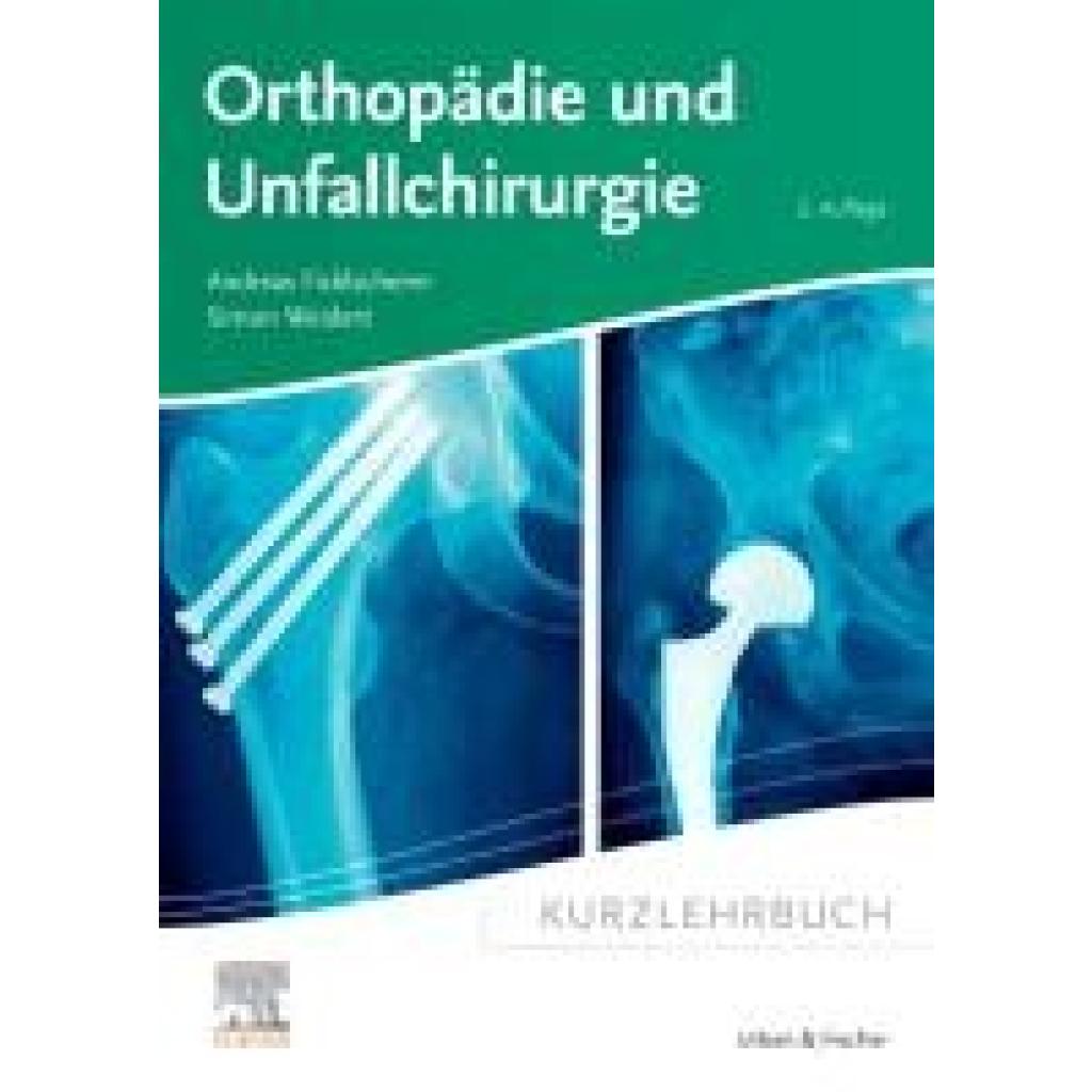 9783437411892 - Ficklscherer Andreas Kurzlehrbuch Orthopädie und Unfallchirurgie