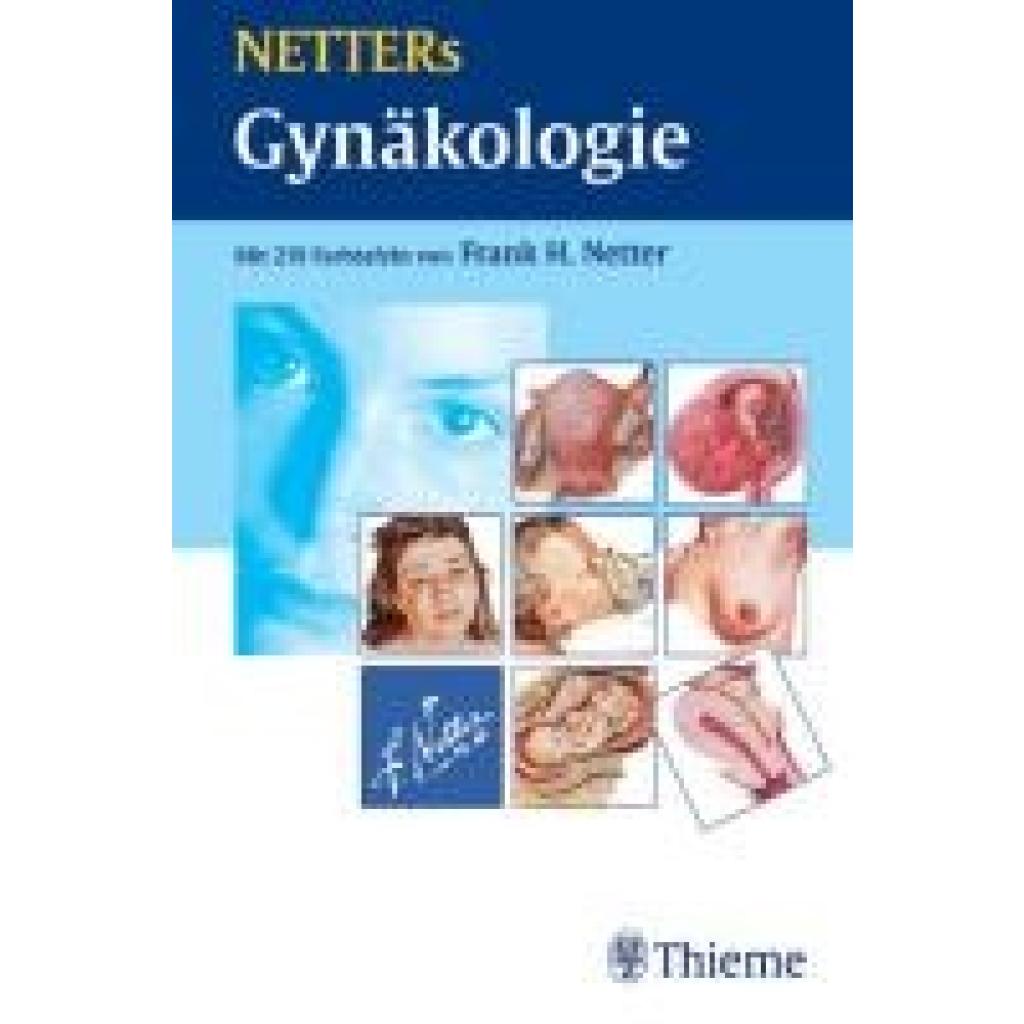 9783131410115 - Netter Frank H - GEBRAUCHT NETTERs Gynäkologie - Preis vom 02062023 050629 h