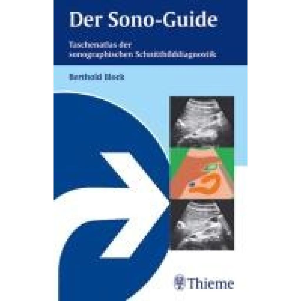 9783131358615 - Der Sono-Guide - Berthold Block Kartoniert (TB) 9783131358615 - Der Sono-Guide - Berthold Block Kartoniert (TB)