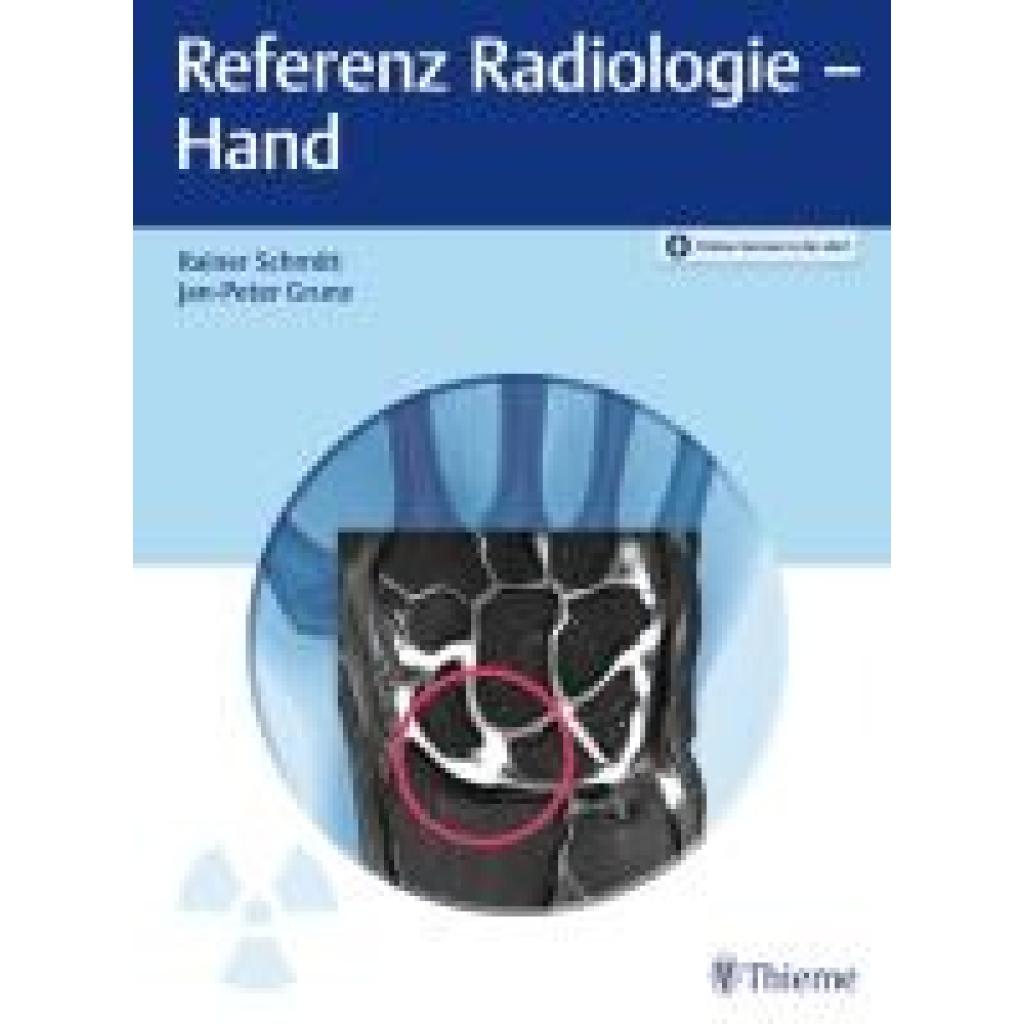 9783132447486 - Schmitt Rainer Referenz Radiologie - Hand