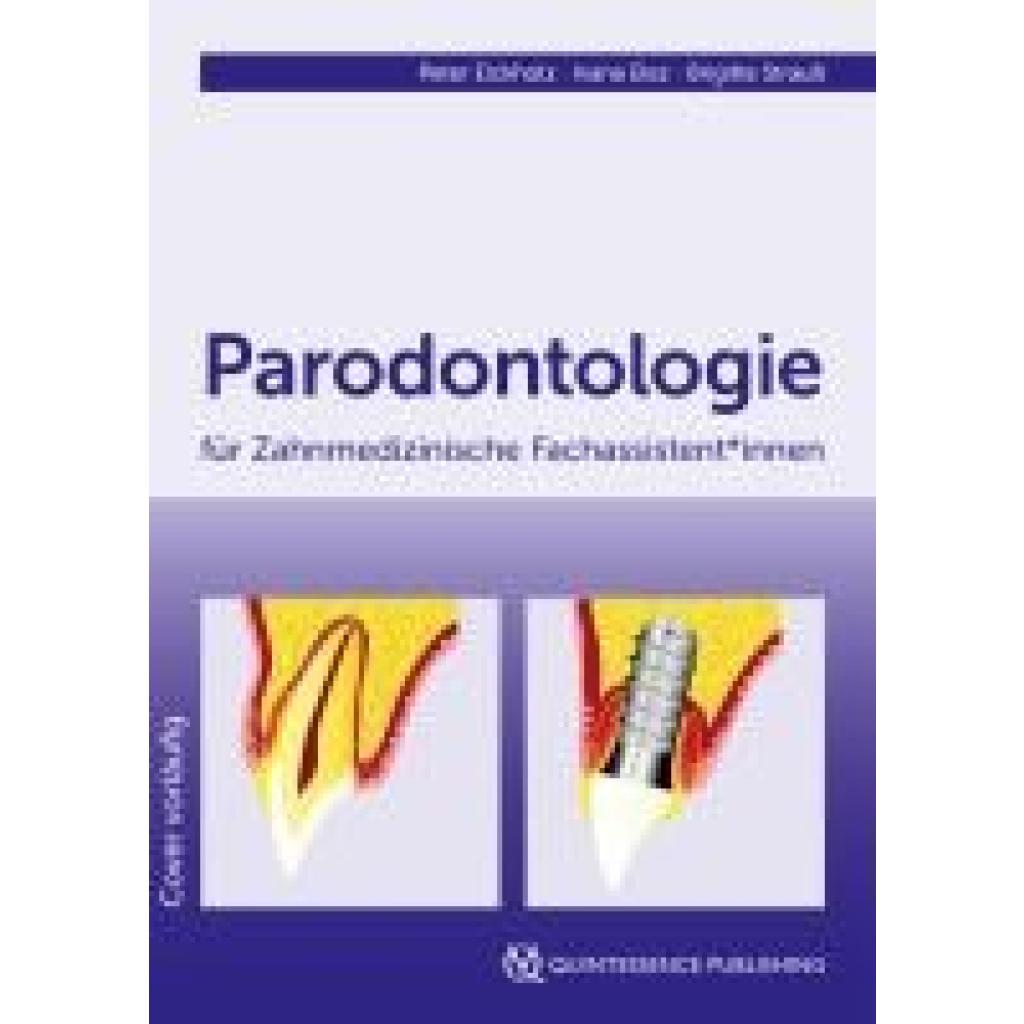 9783868676242 - Parodontologie für Zahnmedizinische Fachassistent*innen - Peter Eickholz Ivana Elez Brigitte Strauß Kartoniert (TB)