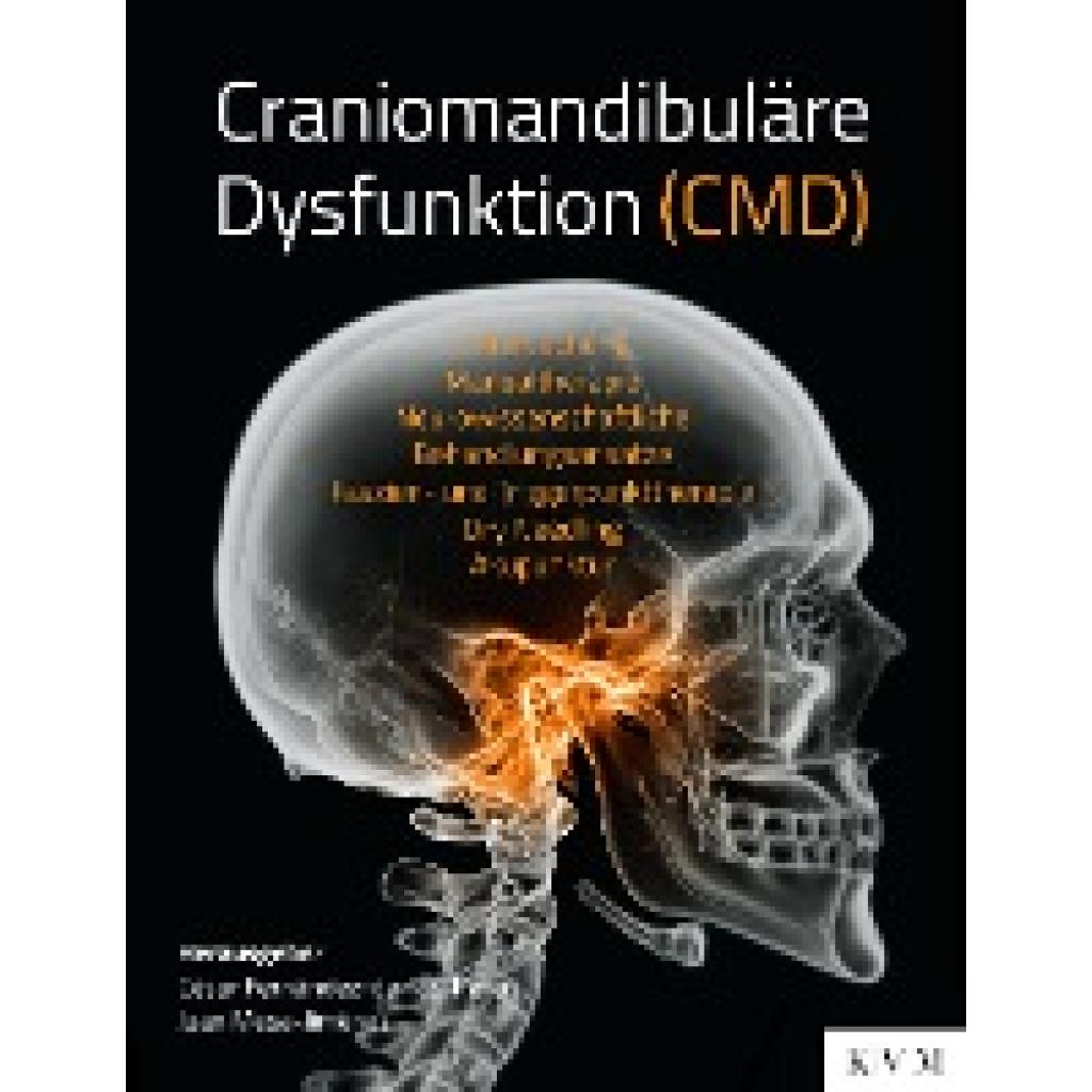 9783868675320 - Craniomandibuläre Dysfunktion (CMD) Kartoniert (TB)