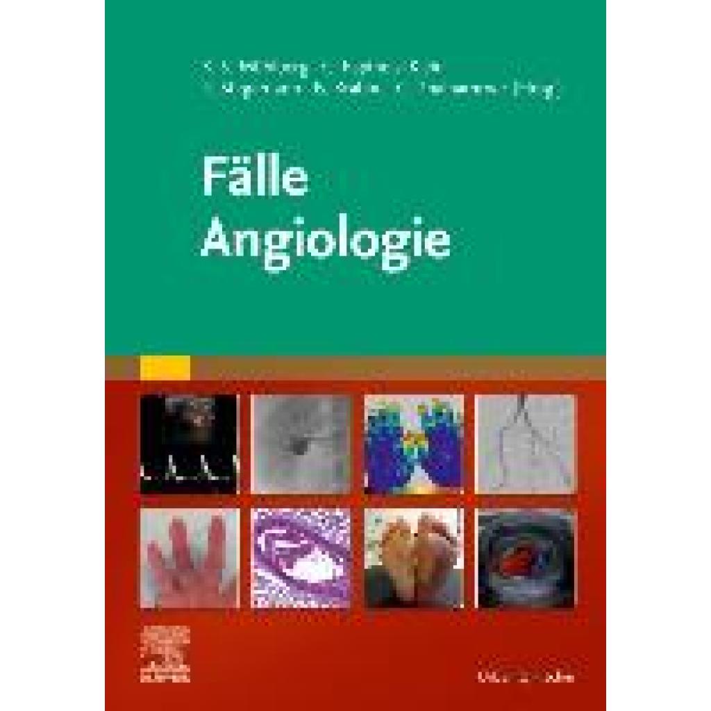 9783437232718 - Fälle   Fälle Angiologie Kartoniert (TB)