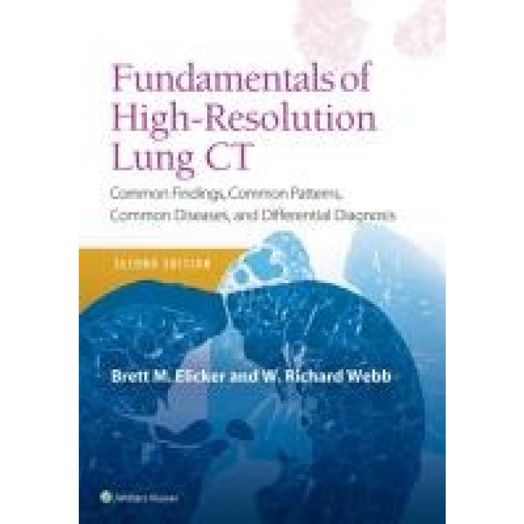 9781496389923 - Fundamentals of High-Resolution Lung CT - Brett M Elicker W Richard Webb Kartoniert (TB)