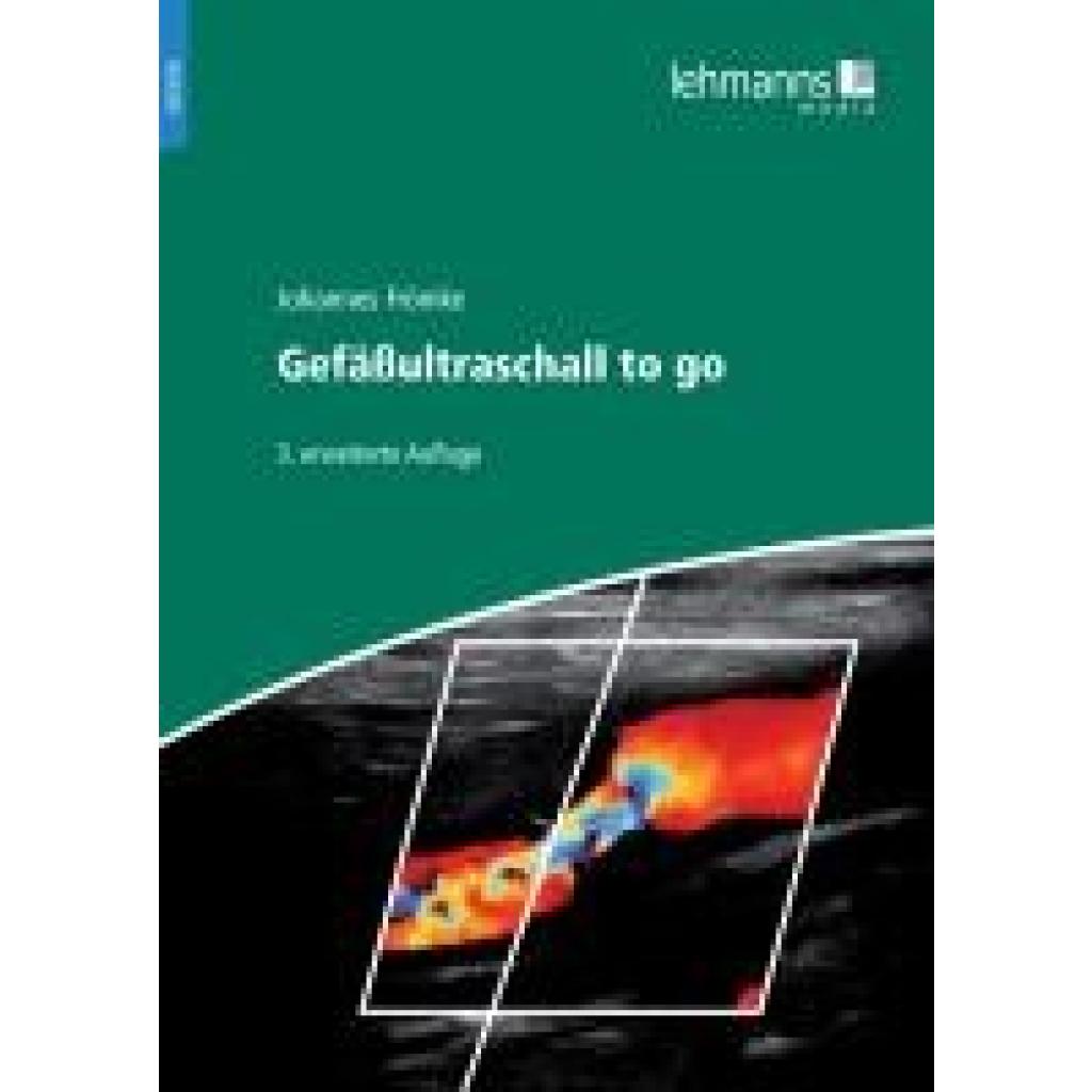 9783965435032 - Frömke Johannes Gefäßultraschall to go