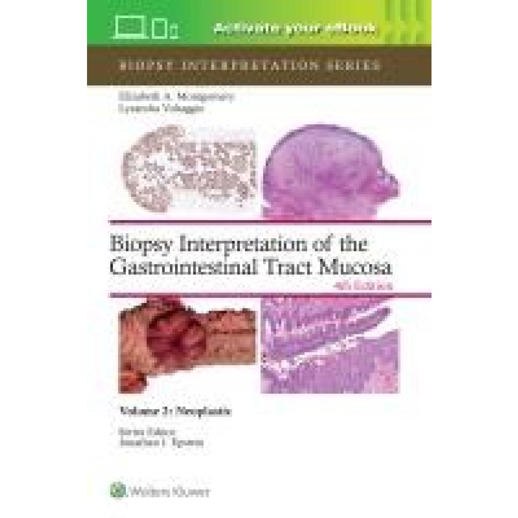 9781975213695 - Montgomery Elizabeth Anne Biopsy Interpretation of the Gastrointestinal Tract Mucosa Volume 2 9781975213695 - Montgomery Elizabeth Anne Biopsy Interpretation of the Gastrointestinal Tract Mucosa Volume 2