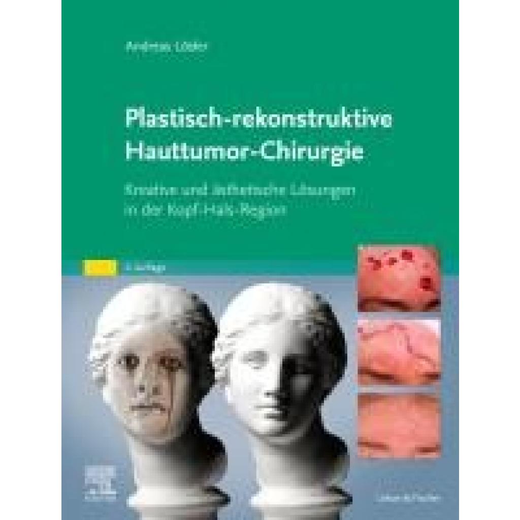 9783437212543 - Lösler Andreas Plastisch-rekonstruktive Hauttumor-Chirurgie