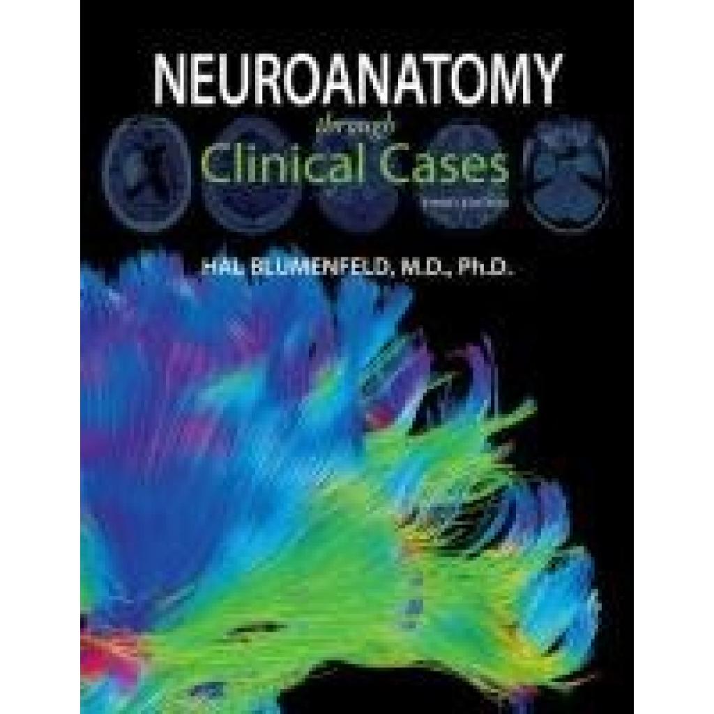 9781605359625 - Blumenfeld Hal Neuroanatomy through Clinical Cases