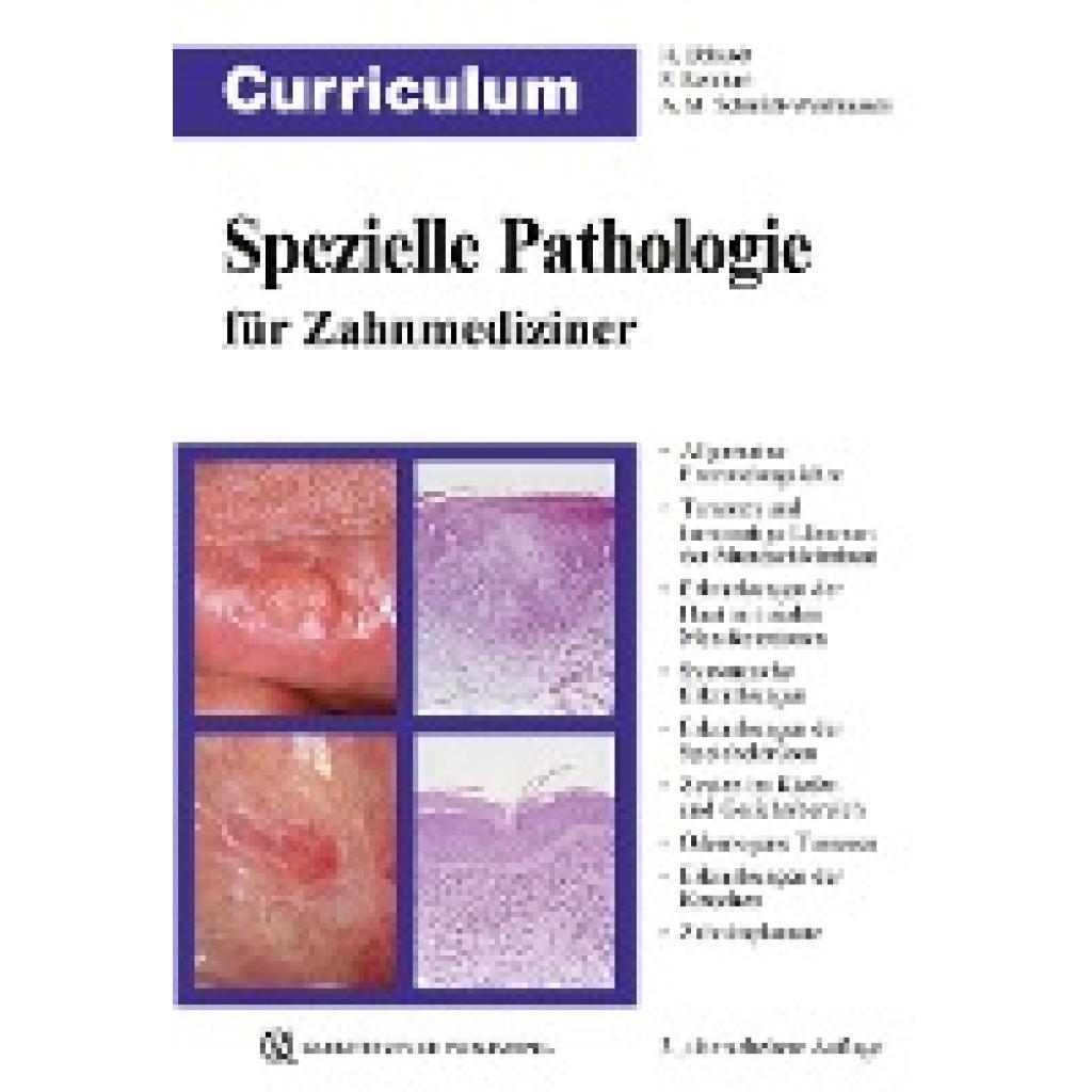 9783868673876 - Curriculum   Curriculum Spezielle Pathologie für Zahnmediziner - Harald Ebhardt Peter A Reichart Andrea Maria Schmidt-Westhausen Kartoniert (TB)